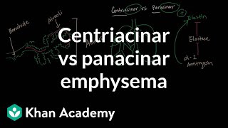 Centriacinar emphysema vs panacinar emphysema  NCLEXRN  Khan Academy [upl. by Lorelie]