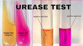 Urea Hydrolysis Urease Test [upl. by Mikiso]