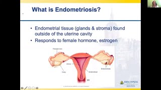 Adenomyosis vs Fibroids Why MRI Is the Gold Standard for Correct Diagnosis [upl. by Ancilin]