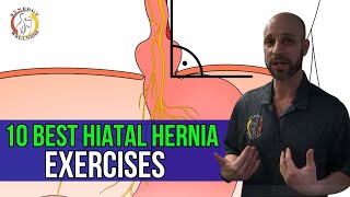 Hiatal Hernia Types Symptoms amp Treatment [upl. by Riella]