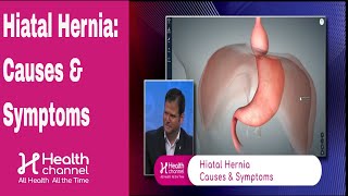 Hiatal Hernia Causes amp Symptoms [upl. by Eatnoj]