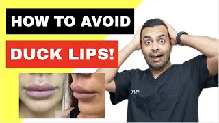 Avoiding DUCK LIPS Causes of LIP FILLER MIGRATION [upl. by Harday920]