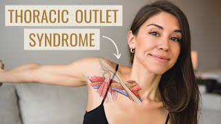 Thoracic Outlet Syndrome Exercises HOW TO FIX IT  Causes Symptoms amp Treatment [upl. by Ahseer382]