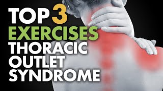 Top 3 Exercises for Thoracic Outlet Syndrome [upl. by Eedyaj]