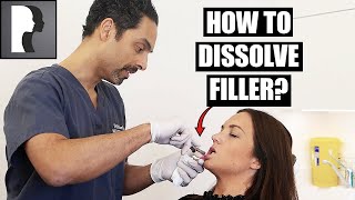 How to dissolve filler [upl. by Zelazny]