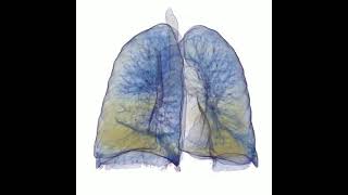 alpha 1 antitrypsin deficiency and smoking [upl. by Jerrylee]