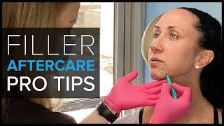 What Happens After a Filler Treatment Bruises Swelling and Aftercare Tips [upl. by Mayap]