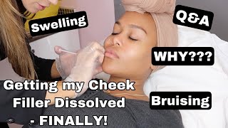 GETTING MY CHEEK DERMAL FILLER DISSOLVED  VLOG  Hyaluronidase Injections 💉 [upl. by Ttessil]