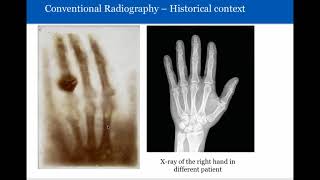 Introduction to Radiology Conventional Radiography [upl. by Elberfeld296]