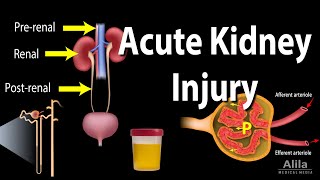 Acute Kidney Injury aka Acute Renal Failure Animation [upl. by Annohsal]